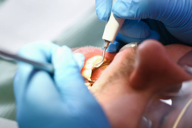 Best Emergency Cosmetic Dentistry (e.g., broken veneers) in Westfield, NJ